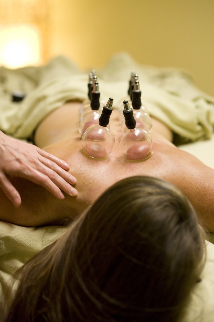 Cupping Therapy