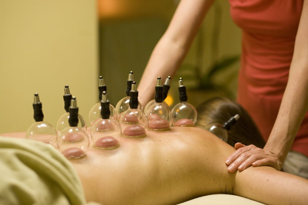 Massage Cupping